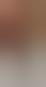 35bikinkverzorgd
