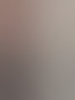 sirdex